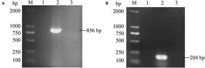 Isolation and characterization of avian leukosis virus subgroup J associated with hemangioma and myelocytoma in layer chickens in China